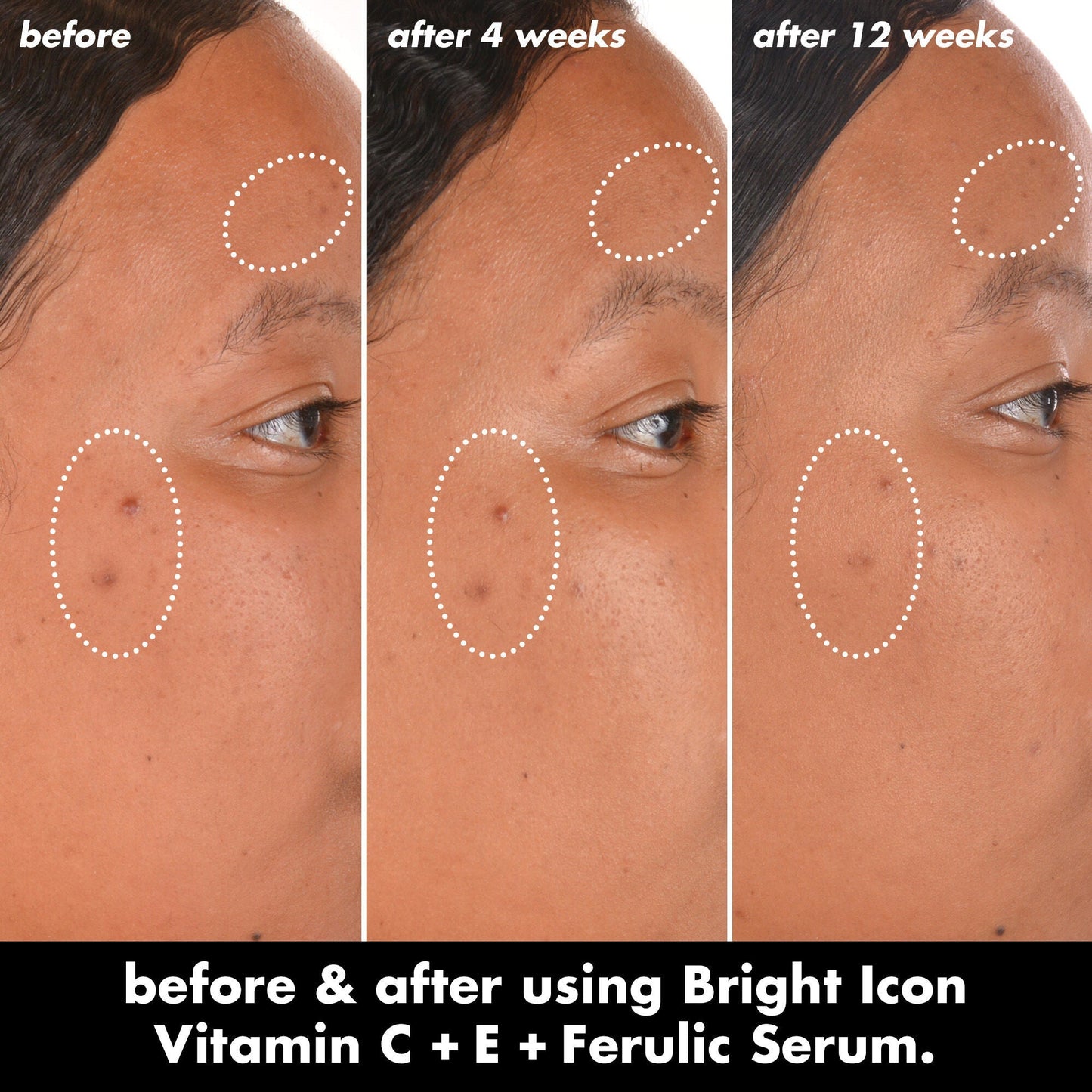 bright-icon-vitamin-c-e-ferulic-serum-f4 0226_EDU_BrightIconVitC_BA_Chanel_TRIPTYCH_c58f2fc8-209d-414f-9ba3-666a07a94887.jpg