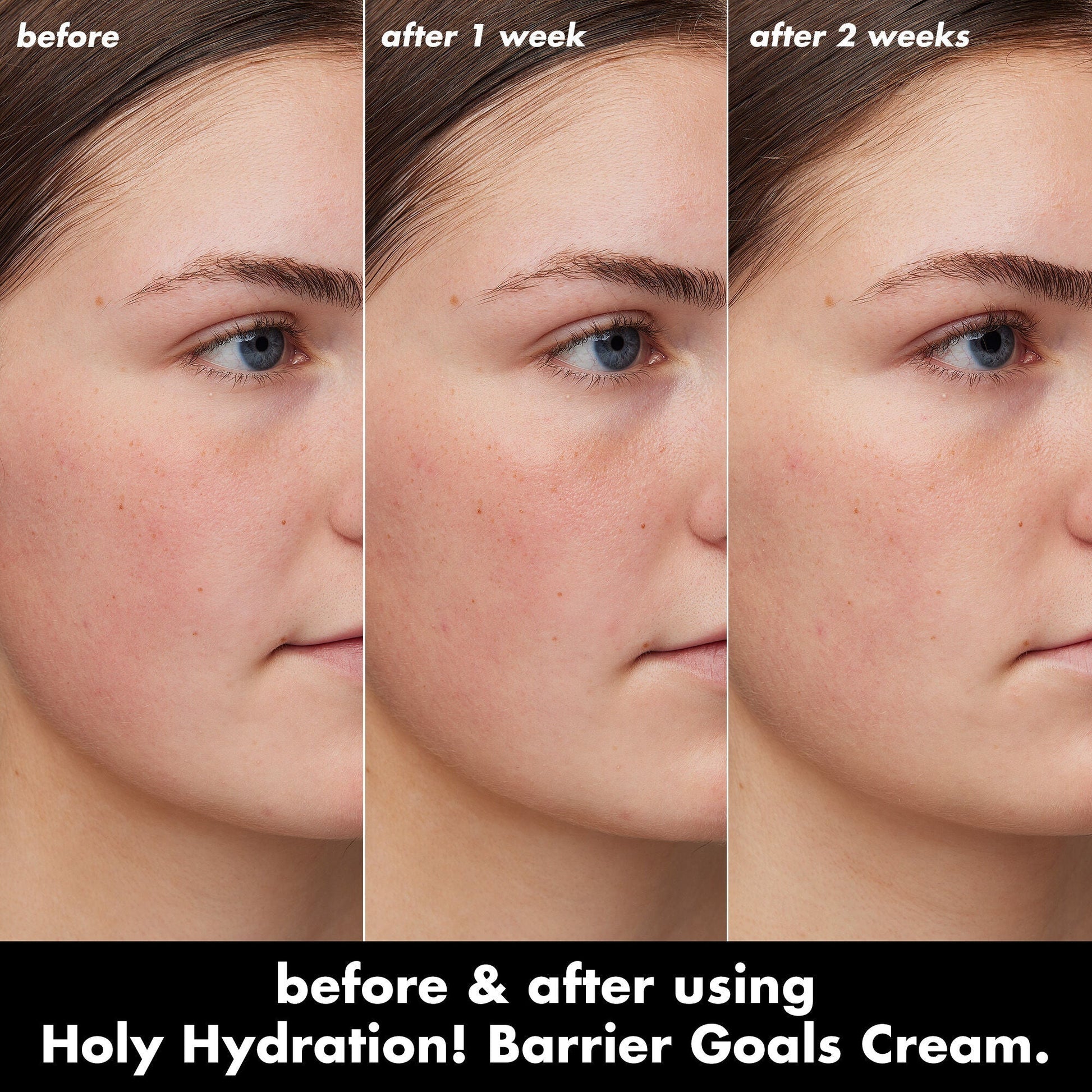 holy-hydration-barrier-goals-cream-q6 0226_EDU_HHBarrierGoalsCream_B_A_Zoe_TRYPTICH_710f5249-3a6b-41fd-89e4-817294dd9258.jpg