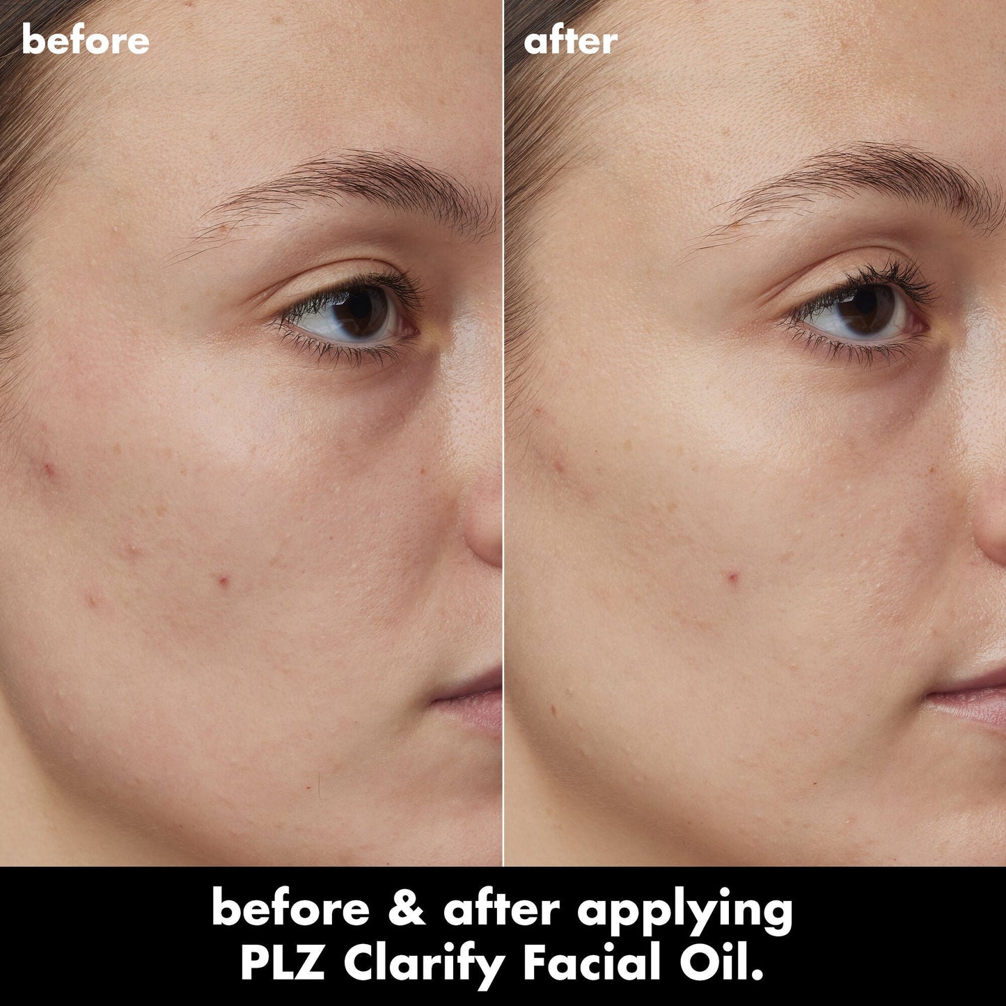 plz-clarify-facial-oil-h9 0326_EDU_PlzClarify_BA_Kelly.jpg