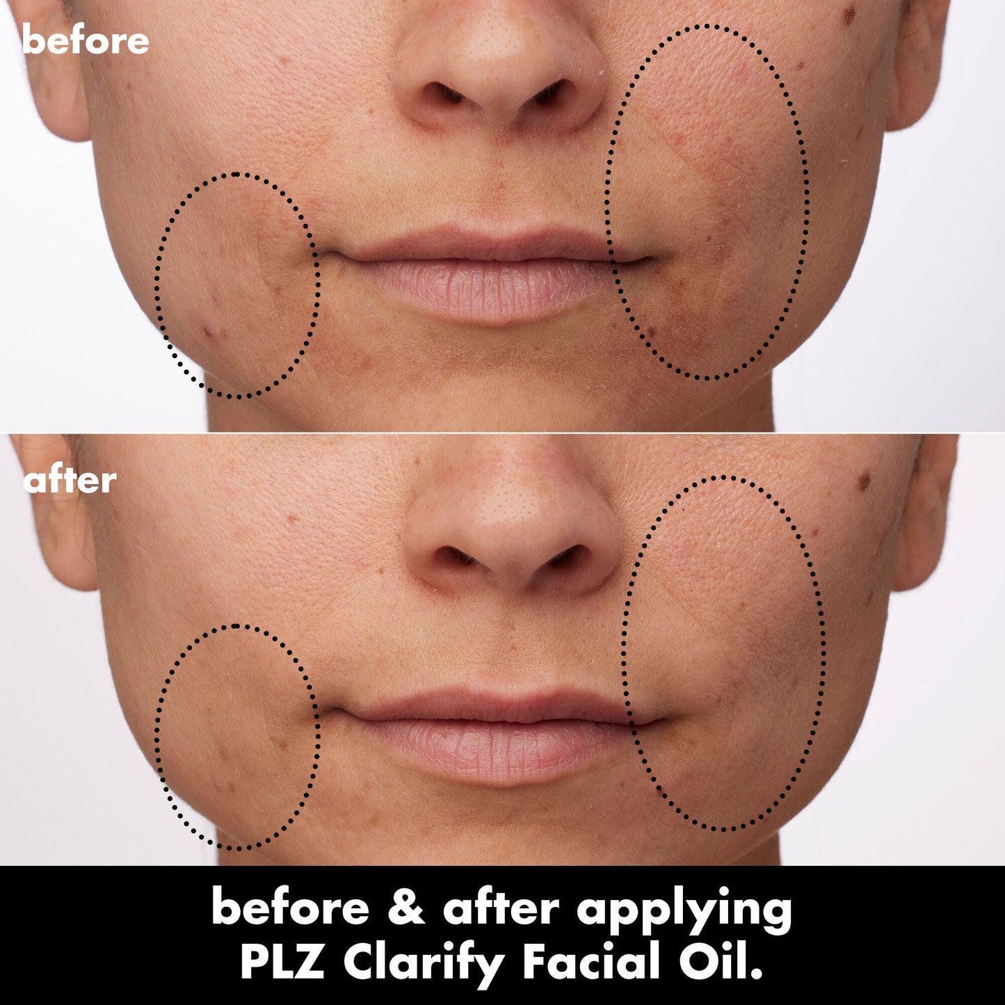 plz-clarify-facial-oil-h9 0326_EDU_PlzClarify_BA_Paula.jpg
