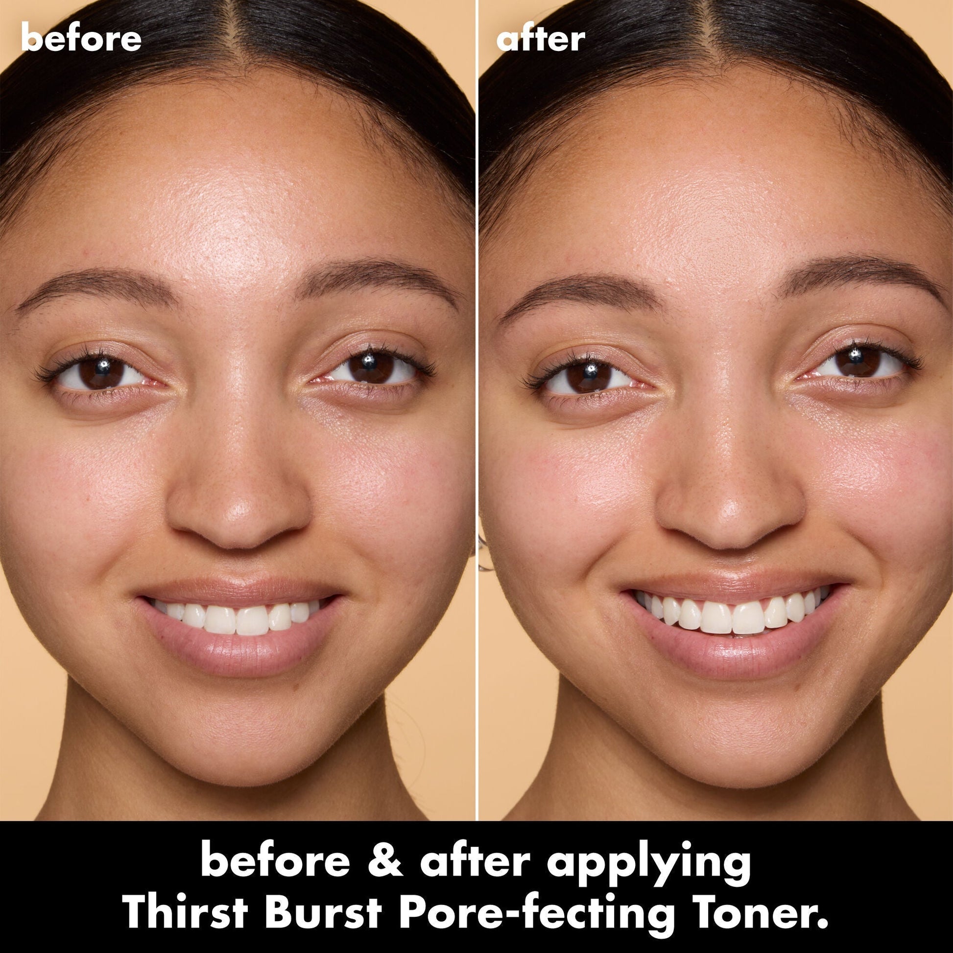thirst-burst-pore-fecting-toner-l6 0326_EDU_THIRSTBURSTTONER_BA_Model2_74314ff2-51ab-45b4-905d-568569dd1359.jpg