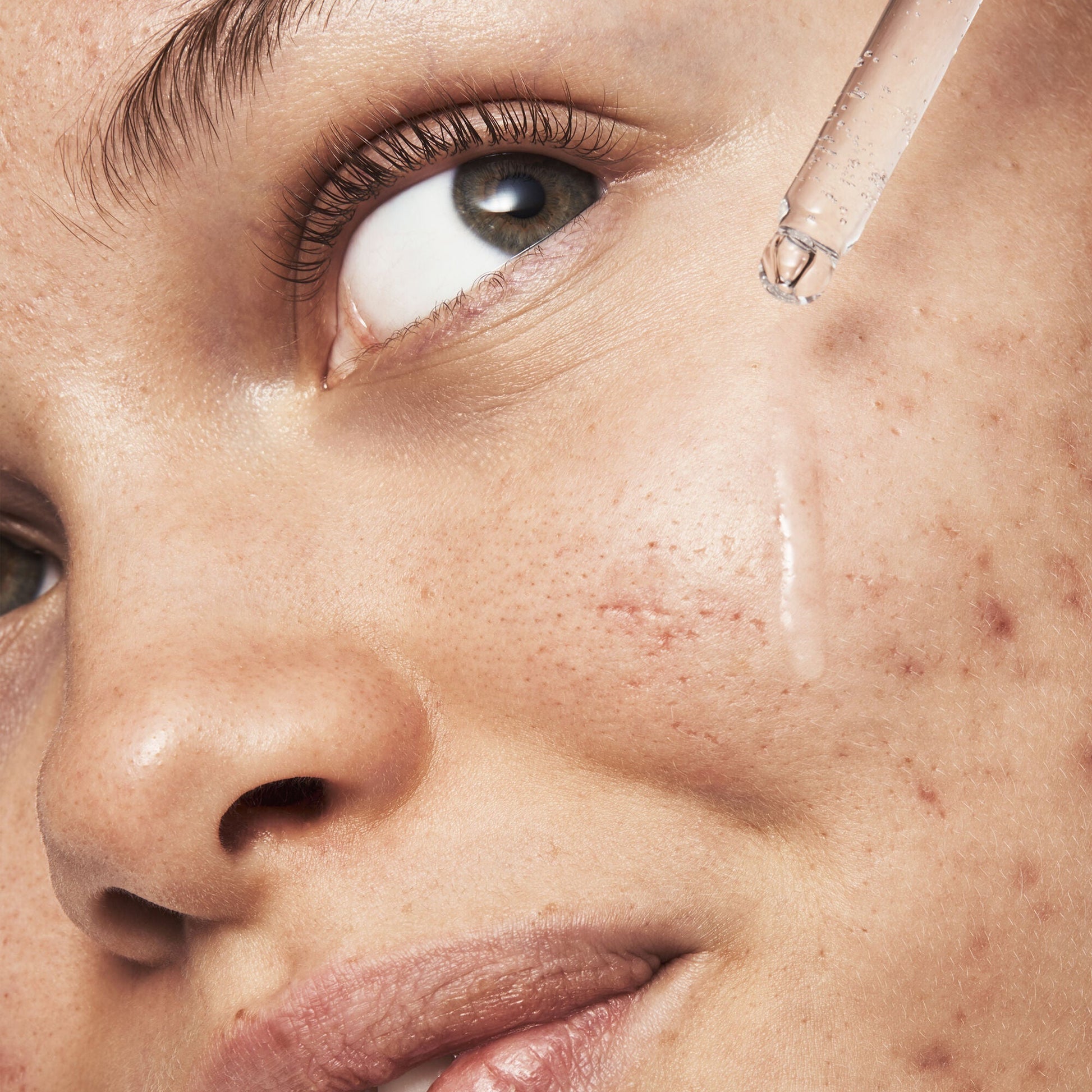 blemish-breakthrough-triple-acid-resurfacing-serum-p2 121321_Marley-Acne-Regimen_0254_FINAL_IGF.jpg